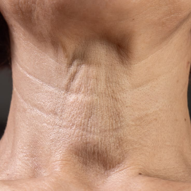 Tech Neck™ is Not Just a Matter of Age
