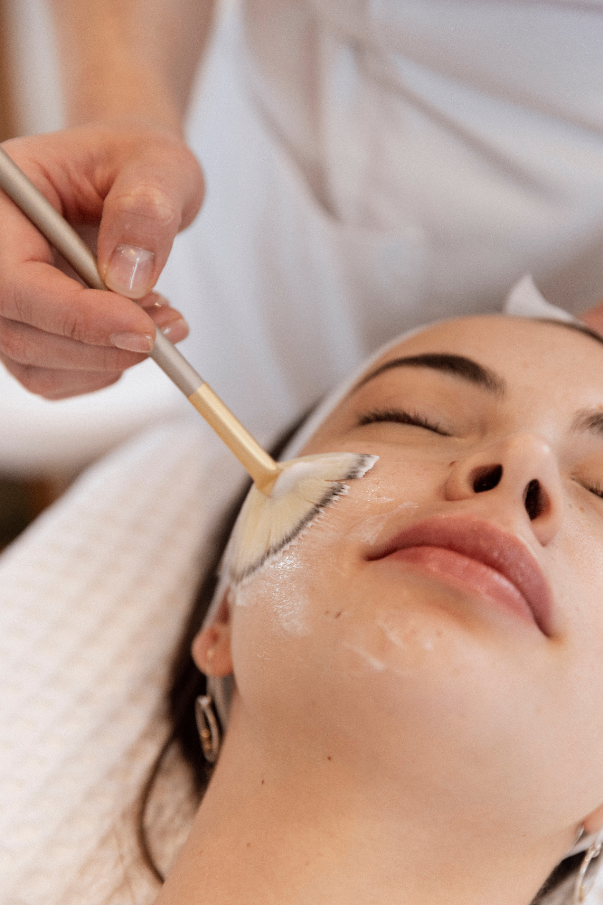 Chemical Peel Process